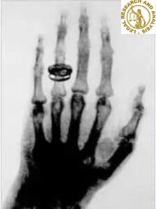 The first X-ray image was ever taken. 