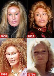 Jocelyn Wildenstein v. Plastic Surgeries 