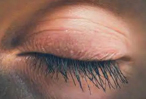 Neuroscientist Race Drivers Blink