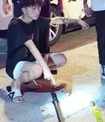 Streamer has his hand cut off a